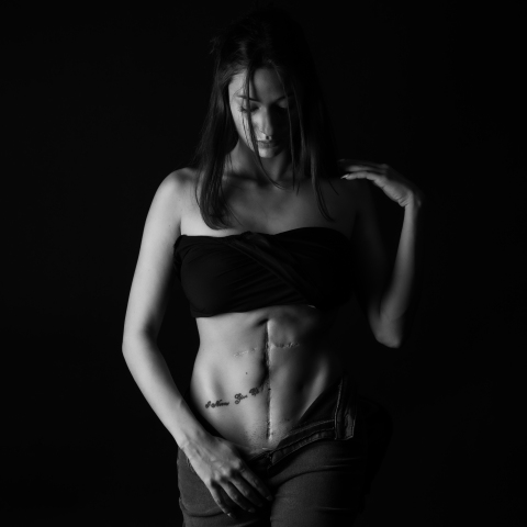 Oυλές στο σώμα