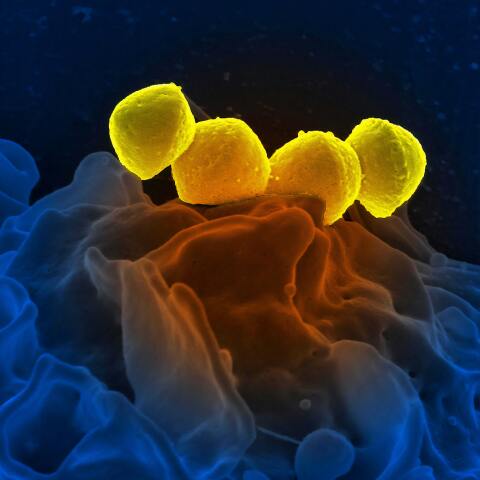 streptococcus