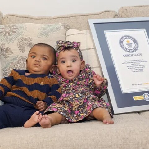 Τα πιο πρόωρα δίδυμα στον κόσμο γεννήθηκαν στον Καναδά