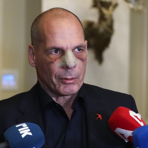 Ο Γιάνης Βαρουφάκης με σημάδια στο πρόσωπο μετά την επίθεση στα Εξάρχεια