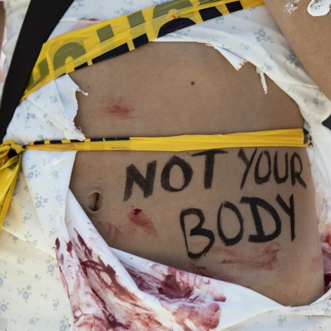 ΗΠΑ: Ομοσπονδιακός δικαστής αναστέλλει την άδεια κυκλοφορίας χαπιού για την άμβλωση - Έφεση από το υπουργείο Δικαιοσύνης - Η αντίδραση του Τζο Μπάιντεν.