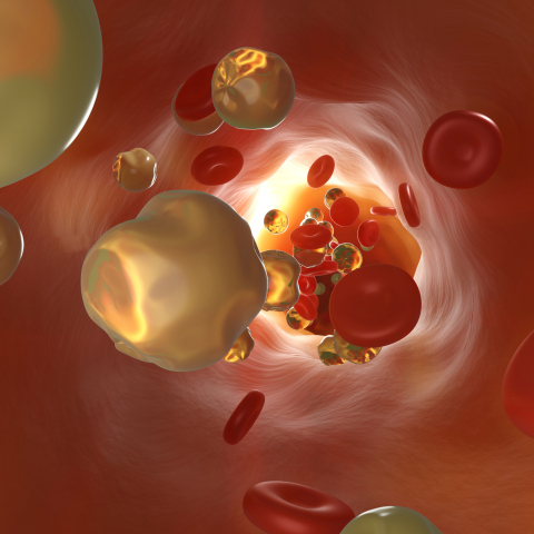 Nexletol: Το νέο σκεύασμα και η φαρμακευτική ουσία κατά της υψηλής χοληστερόλης