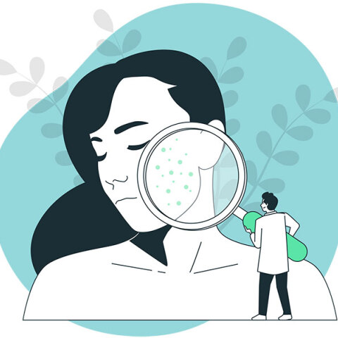 Φάκελος Ψωρίαση: Σύγχρονοι θεραπευτικοί στόχοι