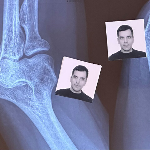 Φωτογραφίες ταυτότητας πάνω σε ακτινογραφία