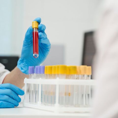 HIV: Υπογράφτηκε η Κοινή Υπουργική Απόφαση για την προληπτική χορήγηση αντιρετροϊκών φαρμάκων (PrEP) - Προϋποθέσεις και διαδικασία συνταγογράφησης.