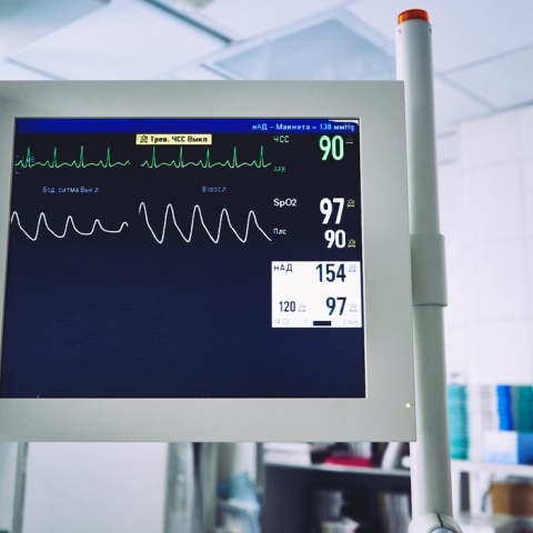 Μηχάνημα που δείχνει τους παλμούς σε Μονάδα Εντατικής Θεραπείας