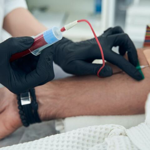 Νοσοκομείο «Λαϊκό»: Πρωτοποριακή τεχνική αλλάζει τα δεδομένα της θεραπείας των ασθενών με Χρόνια Νεφρική Νόσο - Τα οφέλη για τους αιμοκαθαιρόμενους.