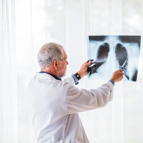 Ιατρός εξετάζει ακτινογραφία στην οποία διακρίνονται οι πνεύμονες