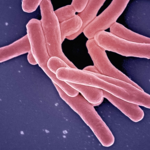 24 Μαρτίου, Παγκόσμια Ημέρα Φυματίωσης 2024