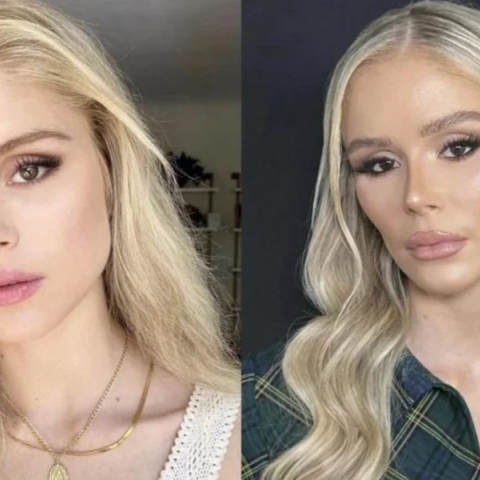 Σχόλιο για τις πλαστικές επεμβάσεις