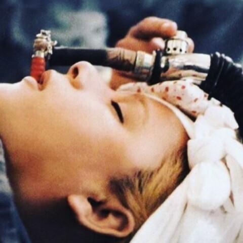 Αλίκη Βουγιουκλάκη: Σπάνια φωτογραφία της από το χειρουργείο