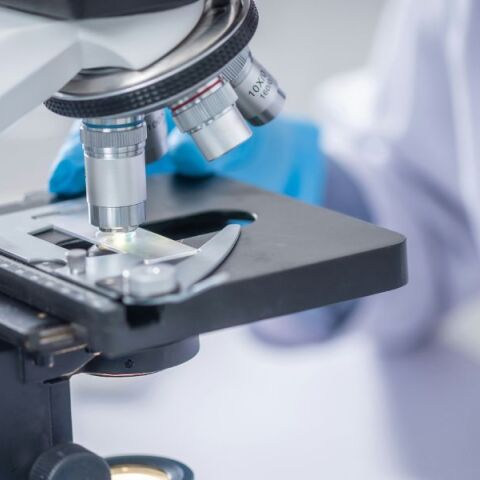 Ηλεία: Νέα δεδομένα στα αίτια θανάτου του 48χρονου «βλέπει» η ιατροδικαστής - Φέρεται να κατέληξε από διεισδυτικό στρεπτόκοκκο και όχι από τσίμπημα αράχνης.