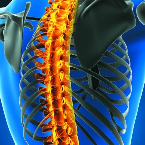 Διάγνωση και αντιμετώπιση της αξονικής σπονδυλοαρθρίτιδας 