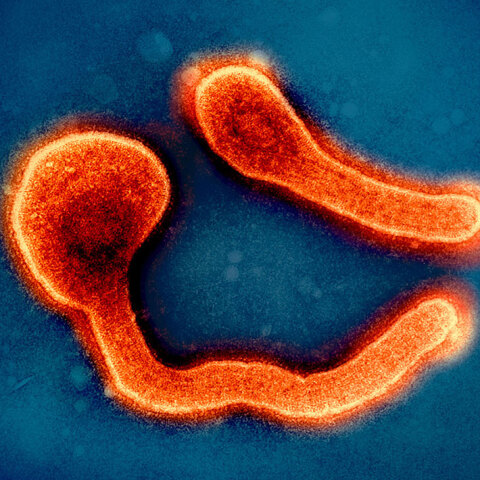 Ο γιατρός Γιώργος Παππάς μιλά για τον θανατηφόρο ιό Μάρμπουργκ