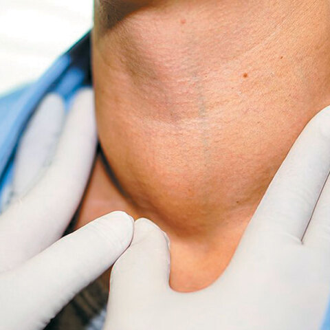 Υπερθυρεοειδισμός: Τι προβλήματα μπορεί να δημιουργήσει και πώς αντιμετωπίζεται;