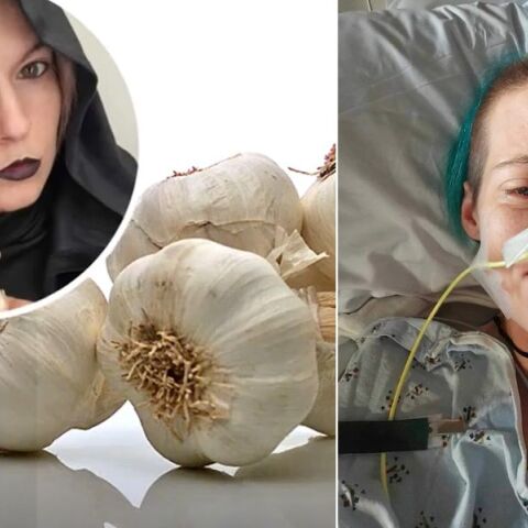 Μια γυναίκα στις ΗΠΑ ισχυρίζεται ότι πάσχει από μια σπάνια «ασθένεια των βαμπίρ» - Τι είναι η οξεία διαλείπουσα πορφυρία που συνδέεται με τον κόμη Δράκουλα.