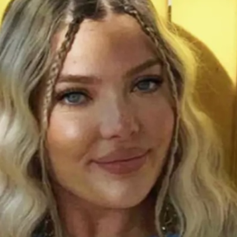 Η Μπρούκλιν που έχασε την όραση από το ένα μάτι, λόγω των φακών επαφής της 