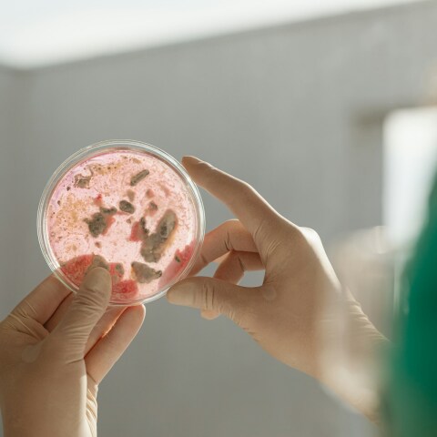 Βακτήρια σε εργαστήριο