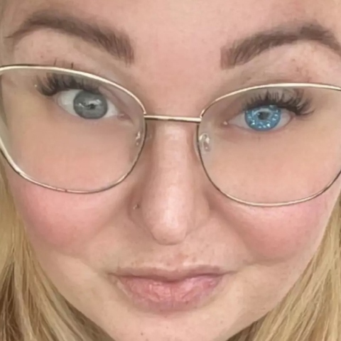 Η γυναίκα που έχασε το μάτι της από την πλέον σπάνια ασθένεια 