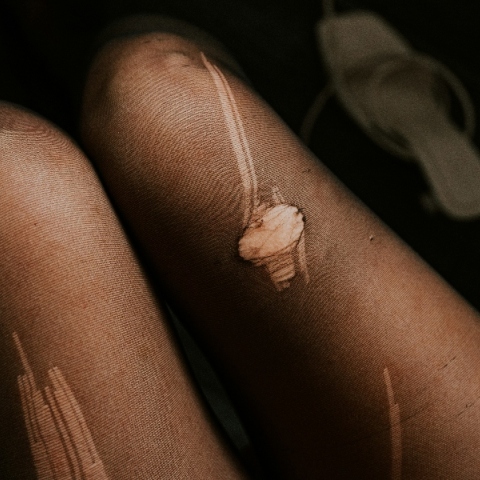 Το απόλυτο hack για να μη σκίζονται τα καλσόν 