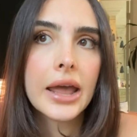 Η Σοφία Ουμάνσκι μιλά για την απώλεια των μαλλιών της μετά από σκληρή δίαιτα και λήψη Mounjaro 