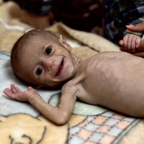 Γάζα: Η ιστορία πίσω από τη φωτογραφία του μόλις 6 μηνών μωρού που συγκλόνισε τον κόσμο
