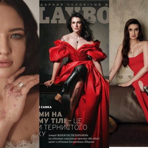 Ουκρανές που τραυματίστηκαν ή ακρωτηριάστηκαν στον πόλεμο φωτογραφίζονται για το Playboy και στέλνουν το μήνυμά τους