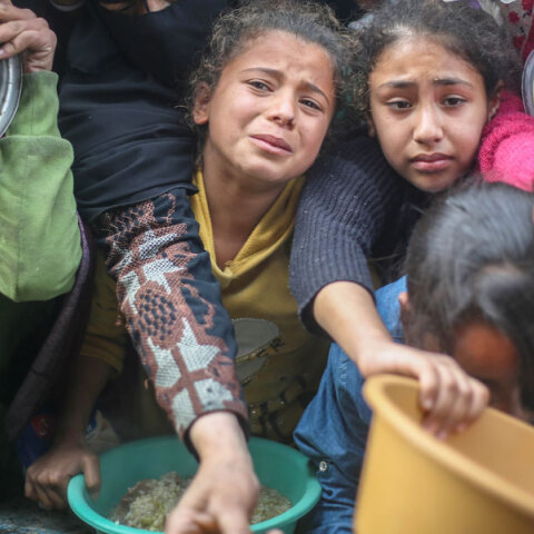 Το πρόσωπο της πείνας στη Γάζα 
