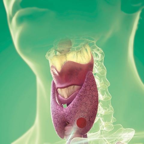 Όζοι θυρεοειδούς – 9 συχνές ερωτήσεις και απαντήσεις