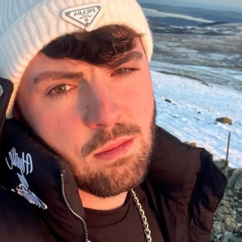 Η περιπέτεια υγείας νεαρού που έκανε εμφύτευση μαλλιών