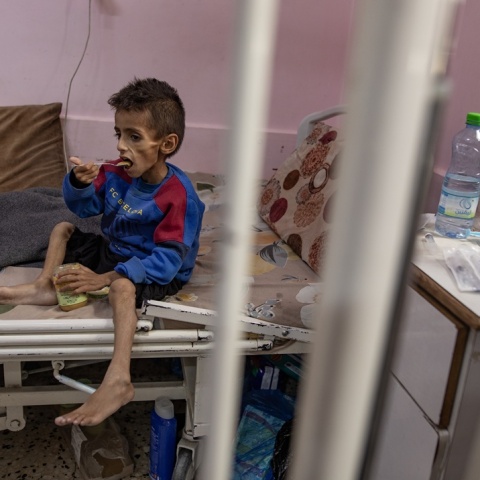 Υποσιτισμένο παιδί στη Γάζα