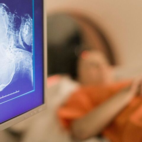 Νέα Υόρκη: 61χρονος πέθανε όταν μπήκε στον χώρο μαγνητικής τομογραφίας φορώντας βαριά μεταλλική αλυσίδα - Η σύζυγός του περιγράφει το σοκαριστικό περιστατικό