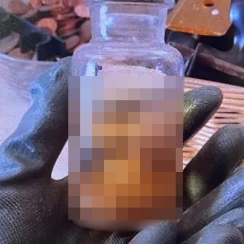 Αττική: Έμβρυο μέσα σε φορμόλη εντοπίστηκε στο σπίτι 77χρονου