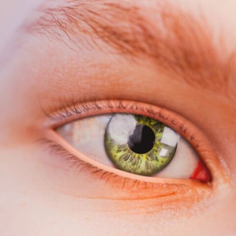 Ένας περίεργος δακτύλιος στην ίριδα του ματιού μπορεί να δείχνει συσσώρευση χαλκού ή αρχόμενη κερατόκωνο, δύο σπάνιες παθήσεις με σοβαρές επιπτώσεις στην υγεία.