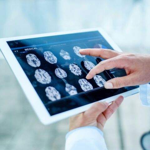 Μελέτη του Πανεπιστημίου Κέιμπριτζ: Ο εγκέφαλος μένει σε εφηβική φάση έως τα 32, με κρίσιμες αλλαγές στα 9, 32, 66 και 83 έτη.