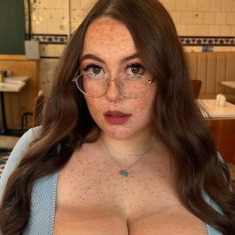 Γυναίκα με υπερβολικά ανεπτυγμένα στήθη διαγνώστηκε με σπάνια πάθηση μακρομαστίας μετά από χρόνια απορρίψεων από γιατρούς - Μίλησε για τις δυσκολίες που βιώνει