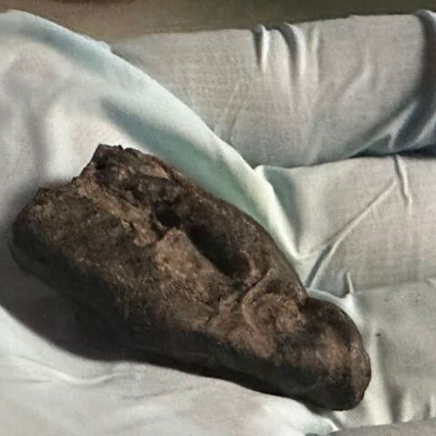 Αρχαίο DNA: Έφηβη μάσησε «τσίχλα» από φλοιό πριν από 10.500 χρόνια στην Εσθονία - Επιστήμονες ανέλυσαν ρητίνη σημύδας με αποτυπώματα δοντιών 