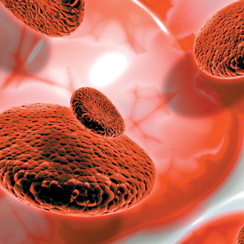 Κυτταρικές θεραπείες: Ελπίδα για τη θεραπεία αιματολογικών κακοηθειών