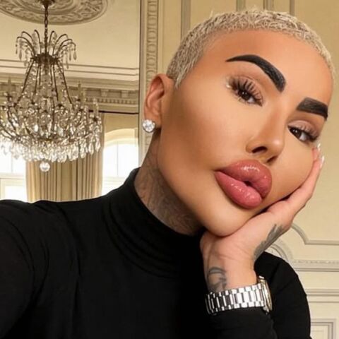 Πέθανε ο Τζόρνταν Τζέιμς Παρκ, γνωστός για τις πλαστικές του επεμβάσεις με στόχο να μοιάσει στην Κιμ Καρντάσιαν - Ήταν υπόδικος για ανθρωποκτονία