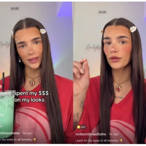 Η influencer έδωσε στη δημοσιότητα τον αναλυτικό λογαριασμό των πλαστικών επεμβάσεων που έχει κάνει 