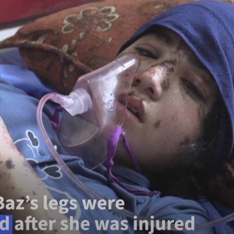 Η 13χρονη έχασε και τα δύο της πόδια μετά από βομβαρδισμό στη Γάζα