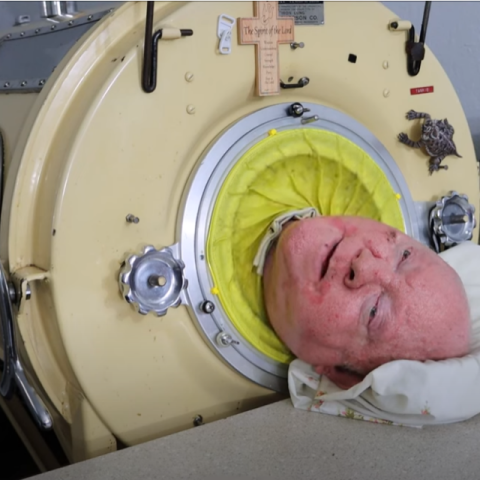 Ο Paul Alexander ζούσε σε σιδερένιο πνεύμονα