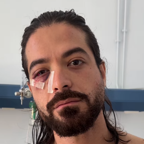 Άρης Μουγκοπέτρος