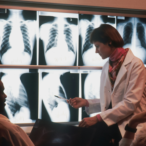 Πώς οι ακτινογραφίες 100.000 ανθρώπων μπορεί να αλλάξουν ριζικά τη διάγνωση και τη θεραπεία των ασθενειών - Τι εξετάζουν οι επιστήμονες