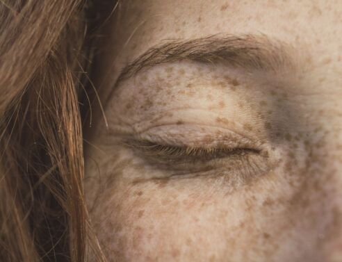 Ψεύτικες φακίδες: Το beauty trend που γίνεται μέχρι και τατουάζ