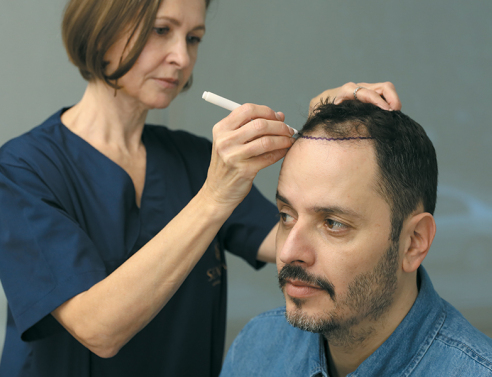 SENECA Medical Group: Σύμμαχός μας στη νικητήρια μάχη κατά της τριχόπτωσης