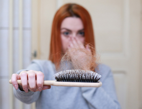 Τριχόπτωση