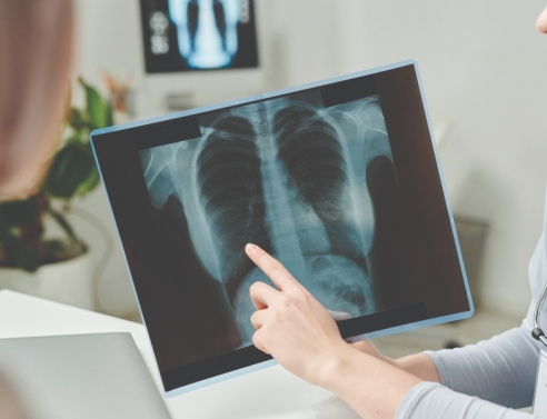 Καρκίνος του Πνεύμονα: Οι νέες θεραπευτικές προσεγγίσεις