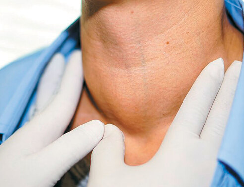 Υπερθυρεοειδισμός: Τι προβλήματα μπορεί να δημιουργήσει και πώς αντιμετωπίζεται;