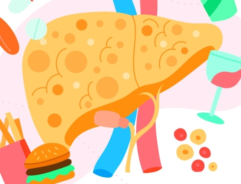 Λιπώδης διήθηση ήπατος | Μέθοδοι πρόληψης και θεραπεία